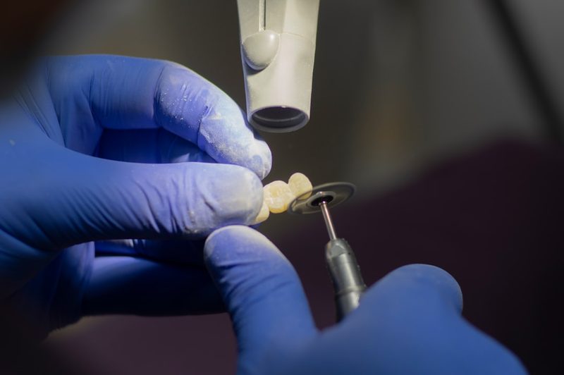 Now Hiring: Certified Dental Technician (Crown & Bridge)