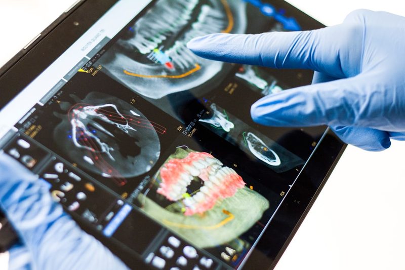 Webinar: Impression Scanning for Edentulous Arches